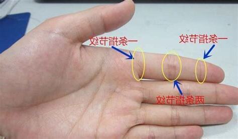 食指橫紋